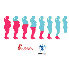 Slider image (8) Obesity Surgical Center | Dr. Jorge Reyes Mendiola